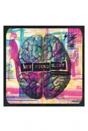 Radiosurgery